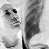 В Ангарске заболеваемость туберкулезом увеличилась на 12%